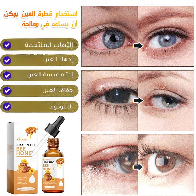 BE3140 | سائل العناية بالعين بالعسل -v4 BE3140 | سائل العناية بالعين بالعسل -v4