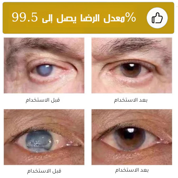 BE3140 | سائل العناية بالعين بالعسل -v4 BE3140 | سائل العناية بالعين بالعسل -v4