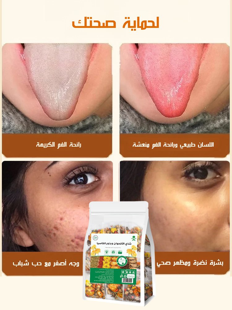 HM4504 | 【هدية كوب】شاي الأقحوان وبذور الكاسيا -v4