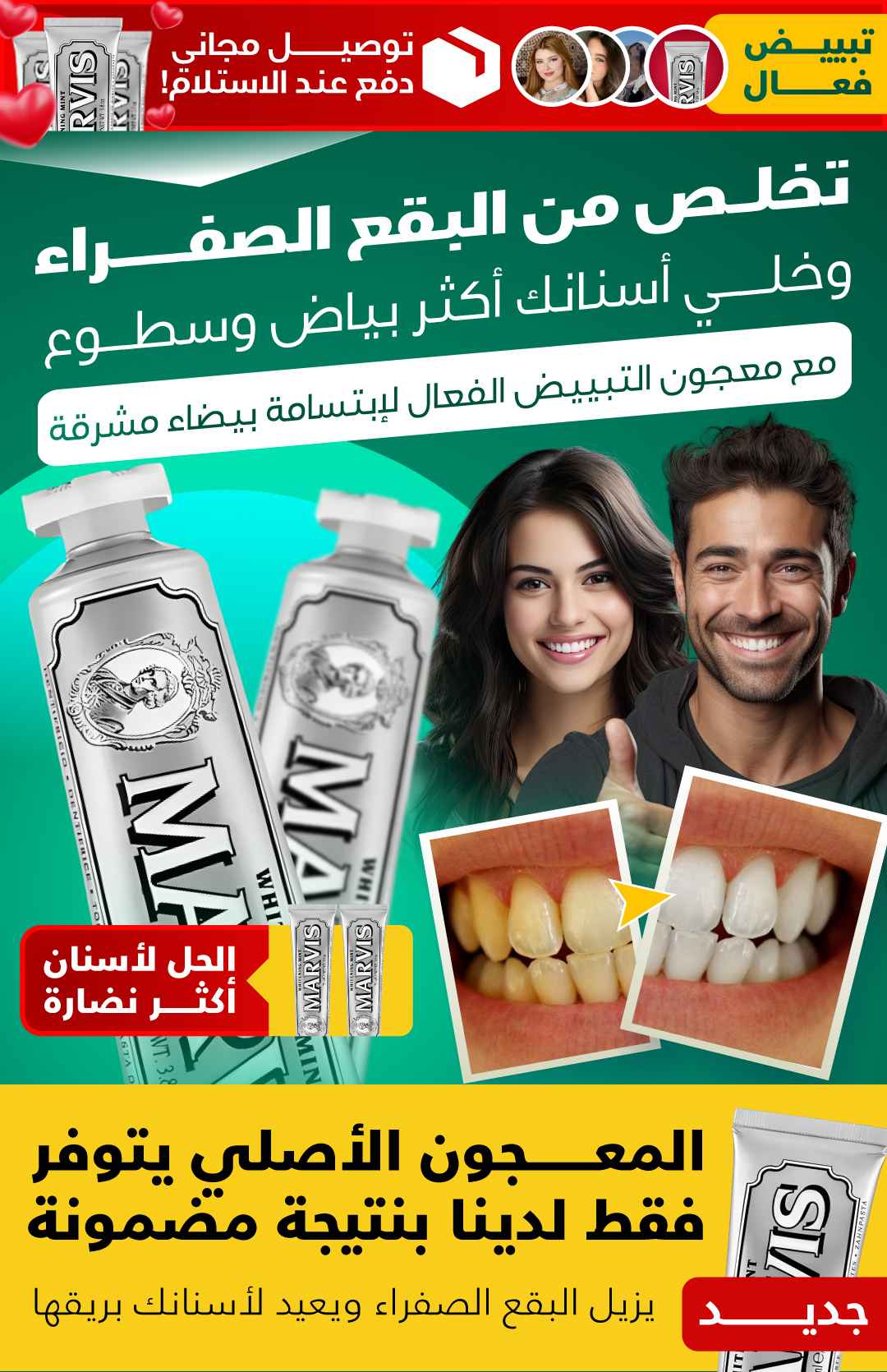 KQL05AHYC | معجون أسنان مارس الإيطالي بنكهة النعناع ينعش النفس ويحمي اللثة  -v4