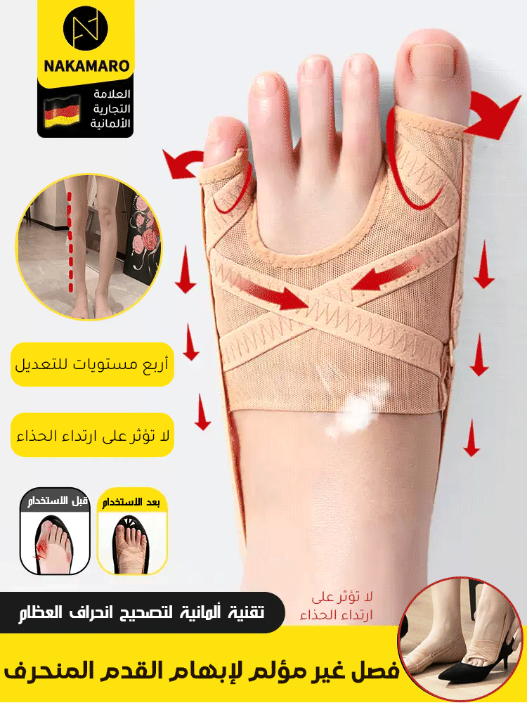 UW3053 | مصحح إبهام القدم الألماني بدون تدخل جراحي -v4