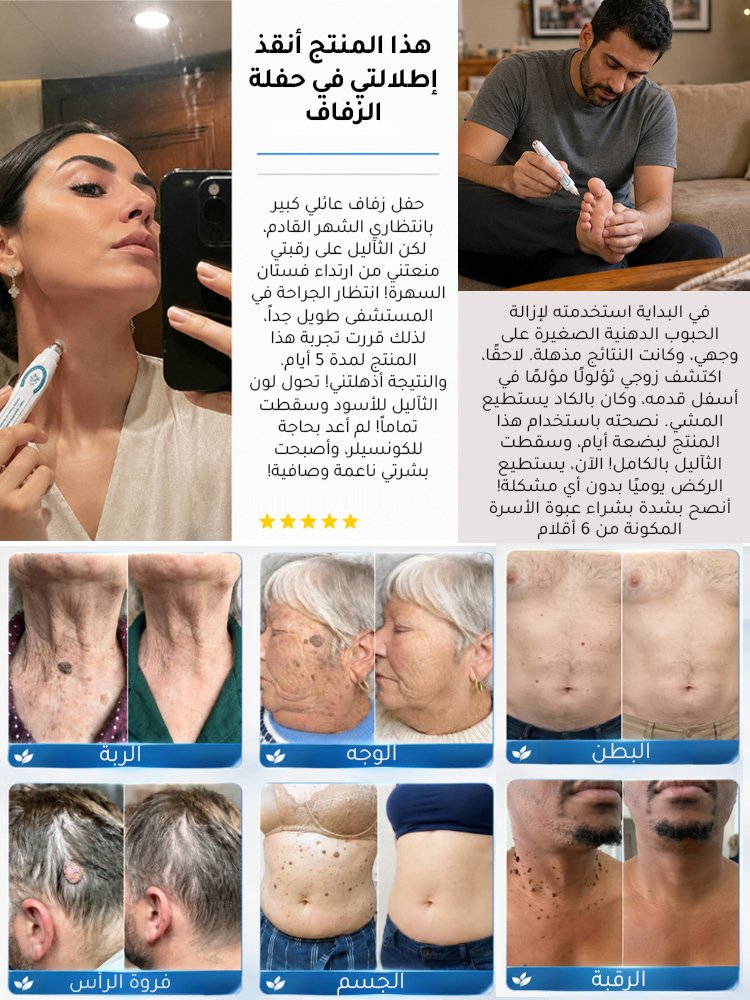 BE3174 | سيروم نباتي لإزالة الثآليل والبقع الداكنة مع أداة وضع كروية دقيقة -v4